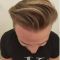 Hair Transplant
