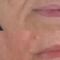 Filler