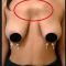 Mastopessi (Lifting seno)