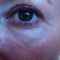Mesotherapie (Revitalisierung von Gesicht, Hals, Dekolleté und Händen)