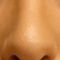 Plastika nosu (Rhinoplastika)