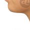 Ultrasonic liposuction