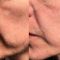 Anti aging