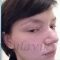 Septoplasty