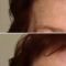 Filler