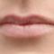 Restylane®