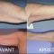 Lifting des bras