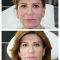 Lifting Facial Silhouette Soft