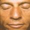 Sculptra