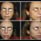 Injections d