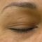 Hydradermabraze