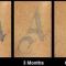 Rimozione tatuaggi - laser