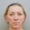 Facelift, SMAS facelifting