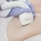 Laser hair removal