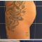 Ingrandimento e rimodellamento glutei e fianchi