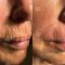 Anti aging