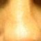 Injections d