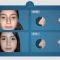 Functional septo-rhinoplasty (rhinoplasty and rhinoplasty)