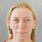 Facelift, SMAS facelifting