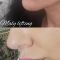 Facelift - Lifestyle lift