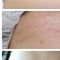 Antiaging