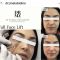 Injections de comblement