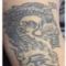 Rimozione tatuaggi - laser