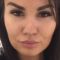Botulinum toxin - Wrinkle Removal