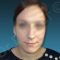 Rhinoplastie