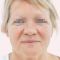 Facelift, SMAS facelifting