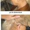 Haarausfall Therapie