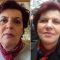 Lifting du visage