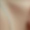 Lifting du visage