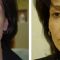 Liquid facelift