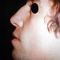 Rhinoplasty (Nose Job)