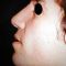 Rhinoplasty (Nose Job)