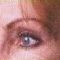 Nichtchirurgische Faltenbehandlung - BOTOX® / DYSPORT®