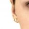 Ear surgery (Otoplasty)