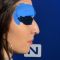 Rhinoplastie médicale