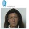 Lifting du visage