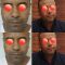 Rhinoplastie