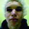 Laser acne treatment