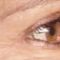 BOTOX®