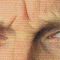 BOTOX®