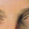 BOTOX®