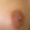 Inverted nipples