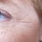 PRP – Plazma terapie (Platelet Rich Plasma)