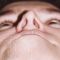 Plastika nosu (Rhinoplastika)