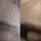 Fotoringiovanimento - resurfacing