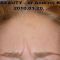 BOTOX®